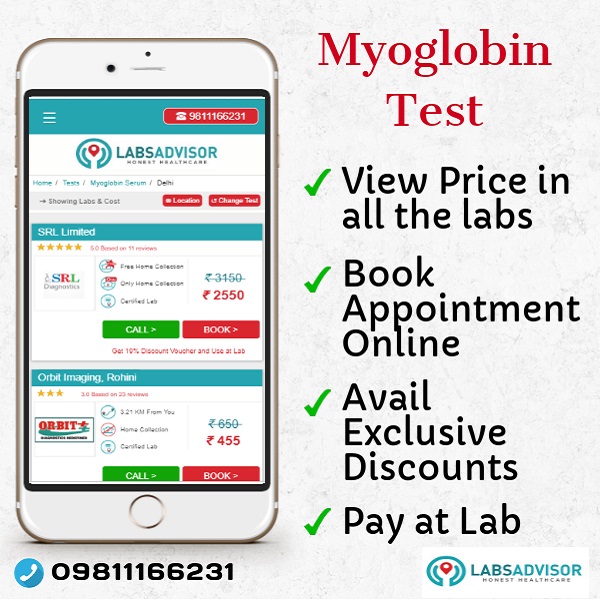 Lowest Myoglobin Test Cost in Delhi, Gurgaon, Bangalore, Mumbai, Chennai, Hyderabad, etc.