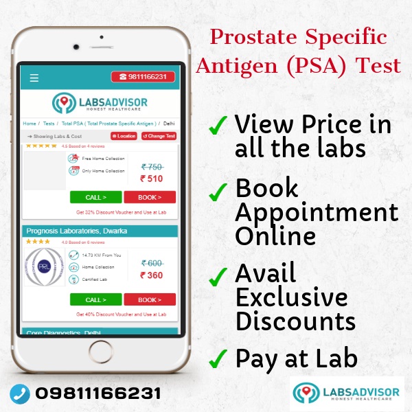 Lowest PSA Test Cost in Delhi, Gurgaon, Bangalore, Mumbai, Chennai, Hyderabad, through LabsAdvisor.