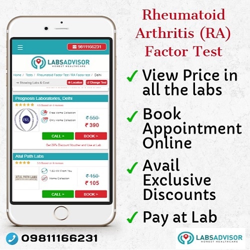 Lowest RA Factor Test Cost in Delhi, Gurgaon, Bangalore, Mumbai, Chennai, Hyderabad, etc.