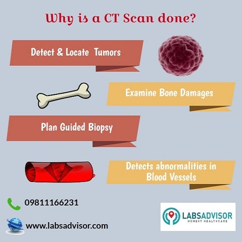 CT Scan in Chandigarh - Purpose!
