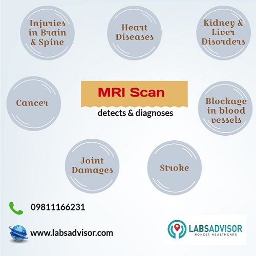 Know more about the reasons behind your doctor recommending an MRI scan in Panchkula