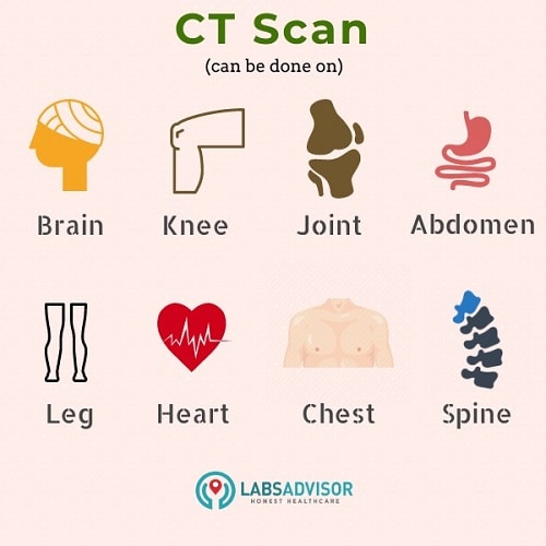 Body parts covered in a CT scan!