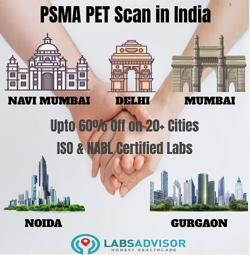 60% Off on PSMA PET Scan Cost - From ₹16000 Only