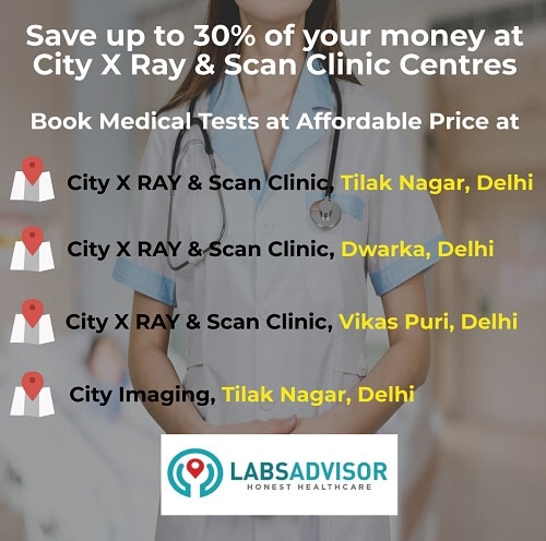 Up to 30% Discount on City X Ray & Scan Clinic Branches in Delhi Through Labsadvisor!