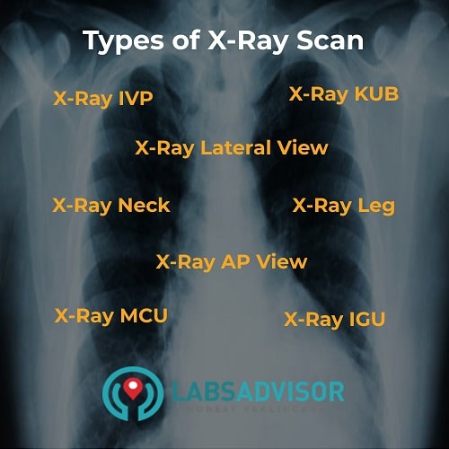 Types of X Ray scan in Navi Mumbai!