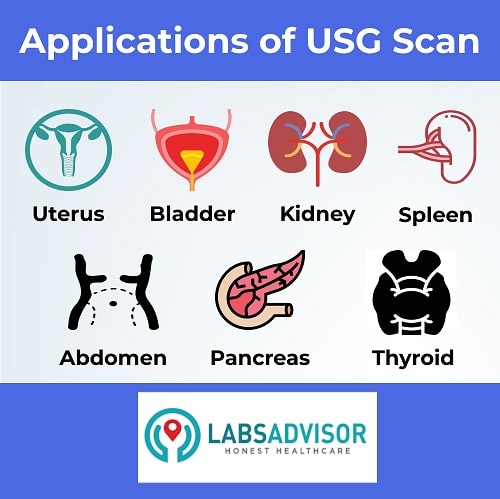 Ultrasound Scan in Mysore!