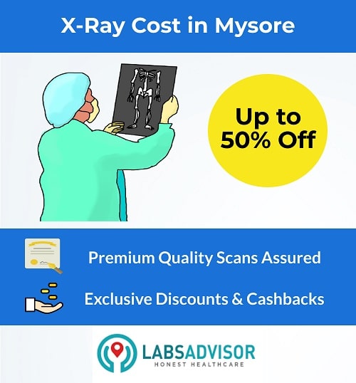 Lowest X-Ray Cost in Mysore!